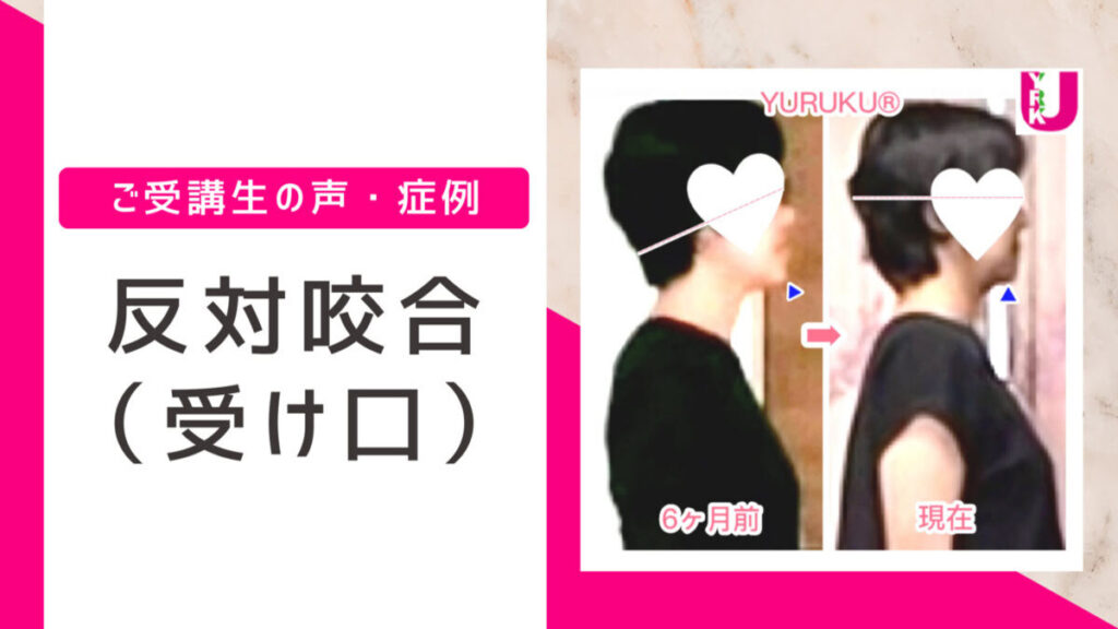 反対咬合（受け口・しゃくれ）が姿勢で改善