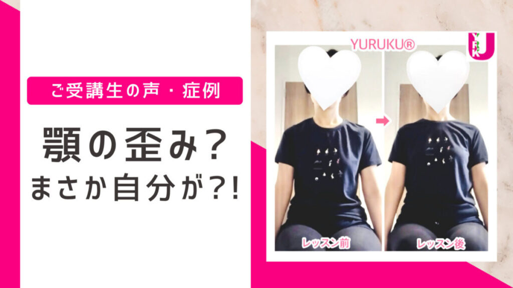 顎の歪み？まさか自分が？！