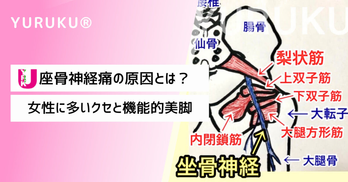 座骨神経痛の原因とは？女性に多いクセと機能的美脚