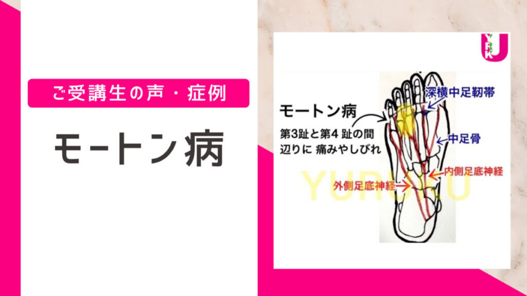 モートン病とは？