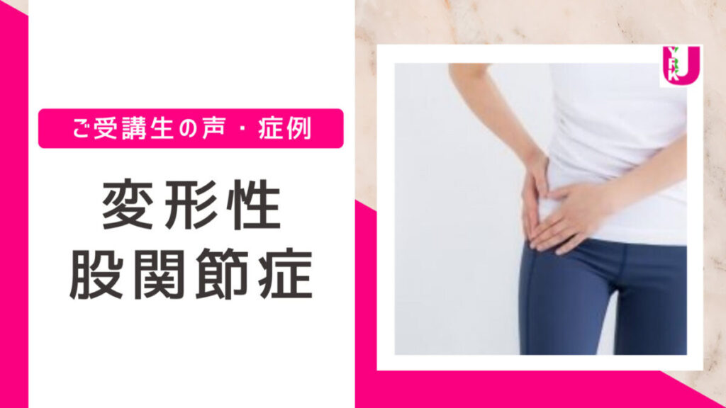 変形性股関節症