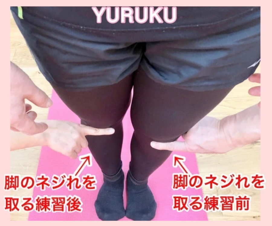 脚のねじれ調整後の左右比較