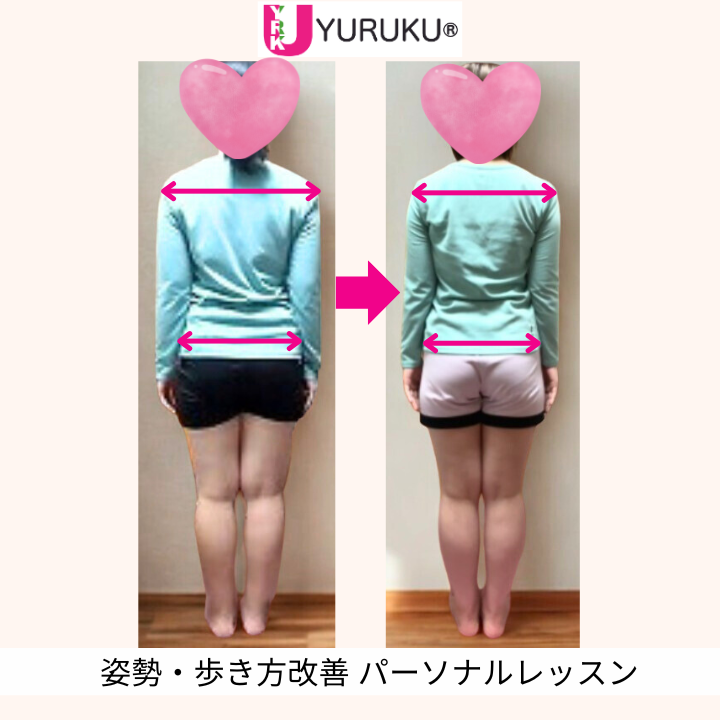 背中と脚のねじれが整い、肩甲骨とヒップラインが改善した後ろ姿の全身写真（顔出しなし）