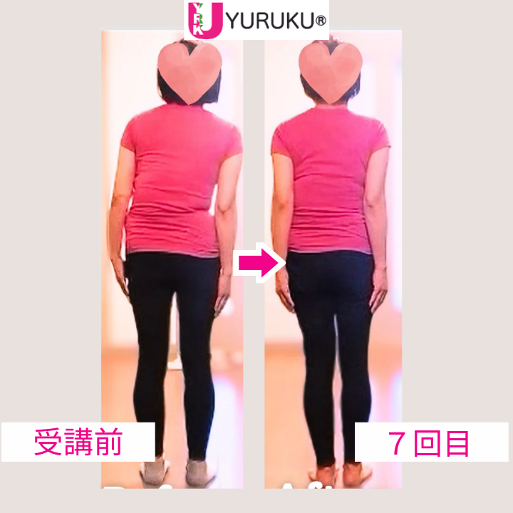 受講前に大きかった背中の左右差が、7回のレッスン後には明確に整ってきた後ろ向き全身写真。