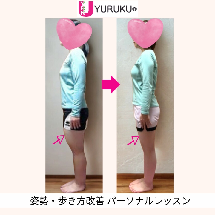 顎の突き出し姿勢と太もも前の張りが改善し、膝上がスッキリした横向きの全身写真（顔出しなし）