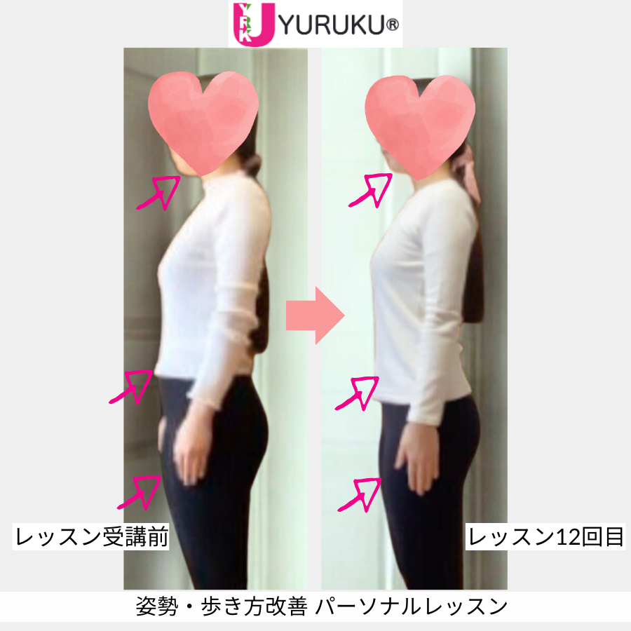 横向き姿勢のビフォーアフター写真で、体のラインの変化が分かる様子