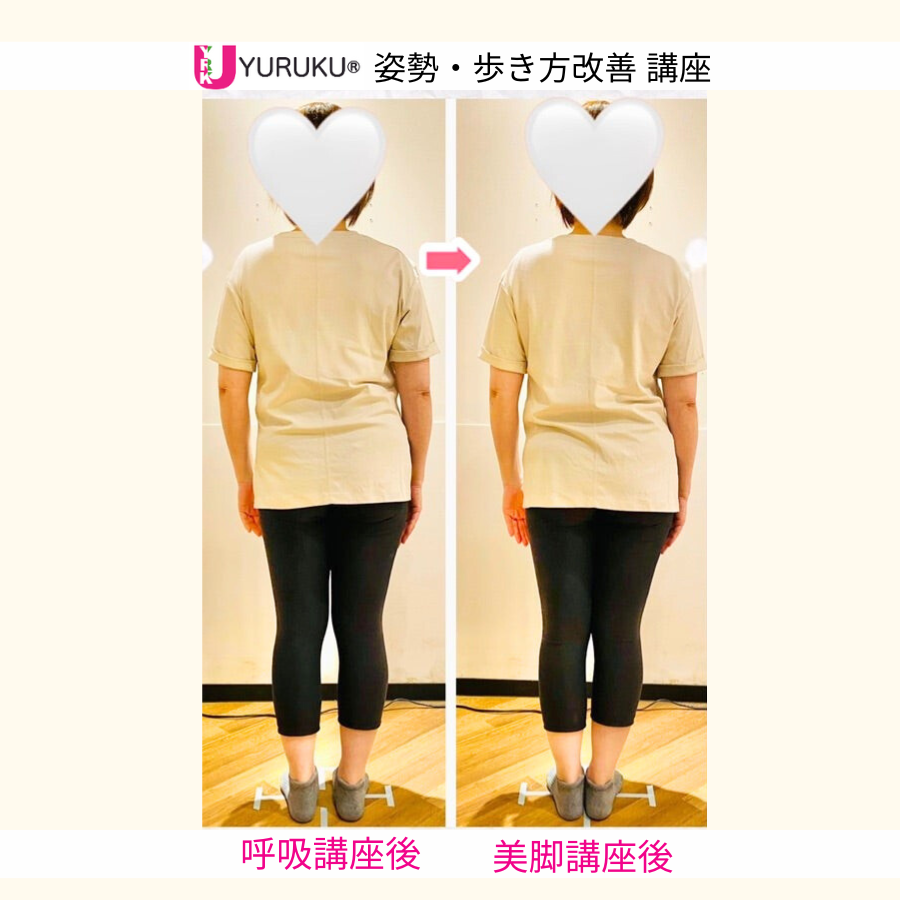 美脚講座によって骨盤と脚のねじれが軽減し上半身の傾きにも変化が現れた全身後ろ姿(50代女性)