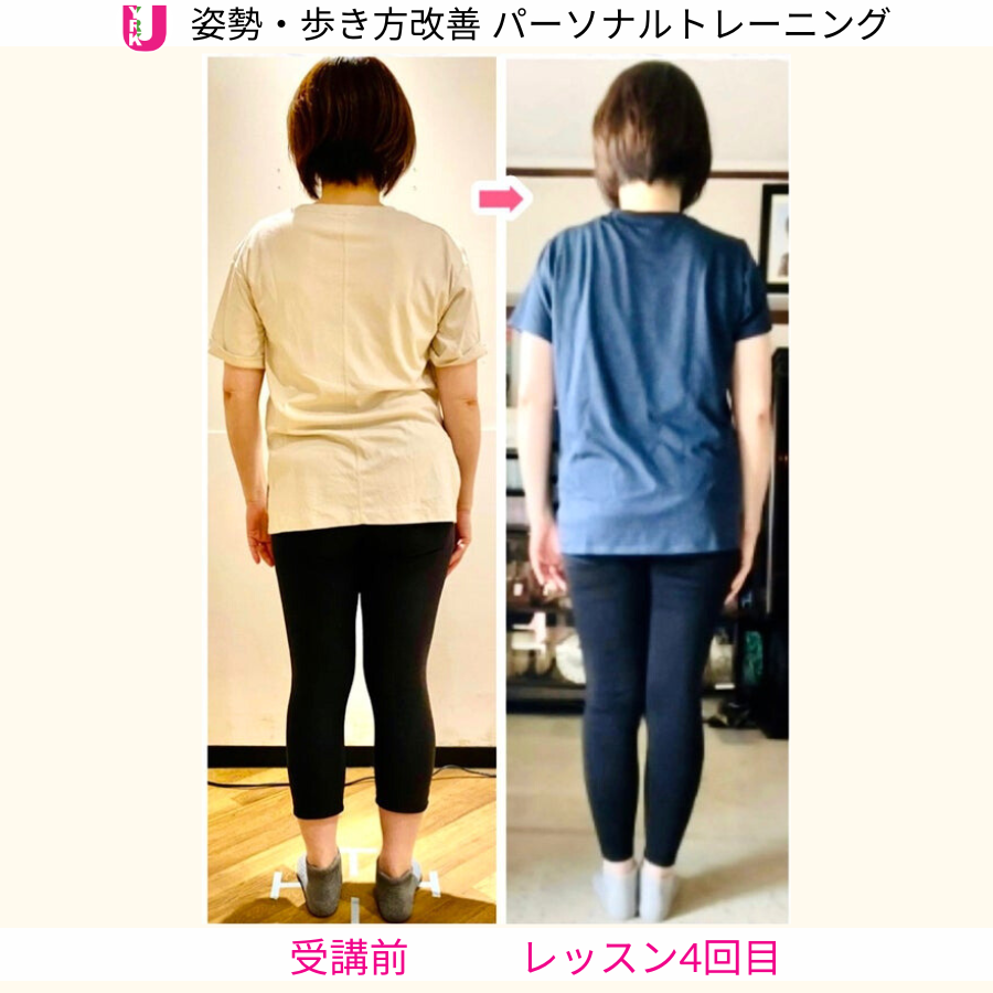 側弯症の生徒さんが3ステップ講座修了後、パーソナルレッスンを重ねて全身のバランスが変化した後ろ姿の比較写真