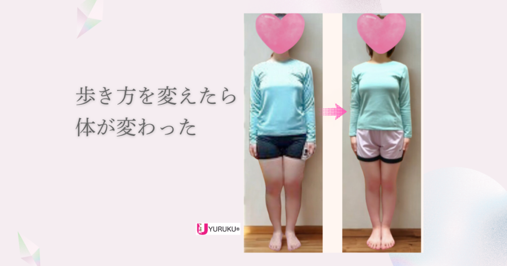 歩き方を見直すことで体とシルエットが変化した実例を紹介した記事のイメージ画像