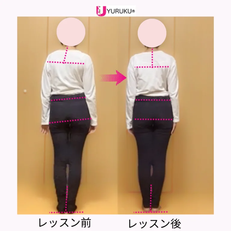 高校生のレッスン前後の姿勢を比較した写真。肩や骨盤、脚などに基準線を引き、身体の変化を確認している